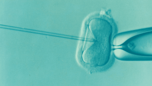 In-Vitro-Fertilisation